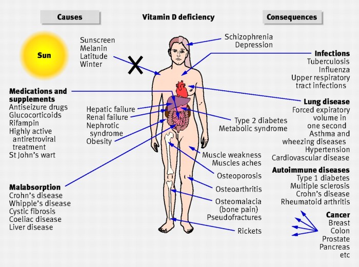 Vitamin deficiency symptoms health causes risk risks signs groups loss cholesterol vdd medications