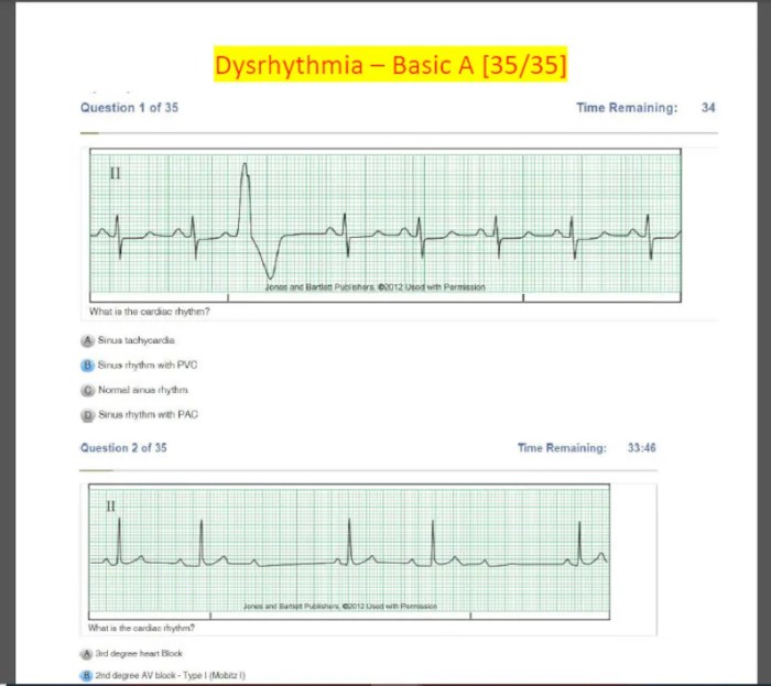 Relias dysrhythmia basic a answers